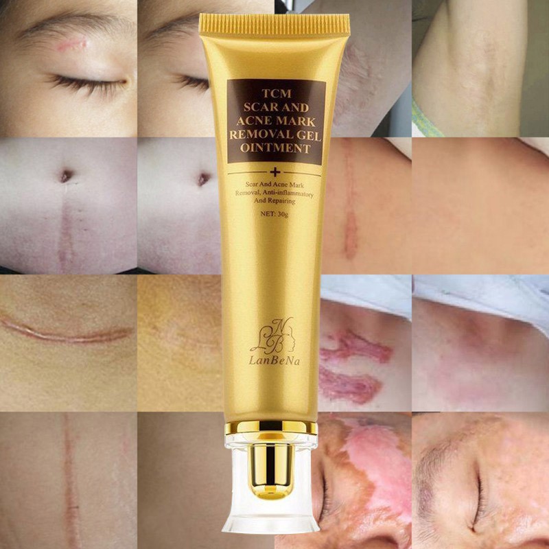 the-10-best-scar-removal-creams-that-actually-work